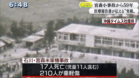 Qプラスリポート 宮森事故59年 医療報告書が示す事故の実相
