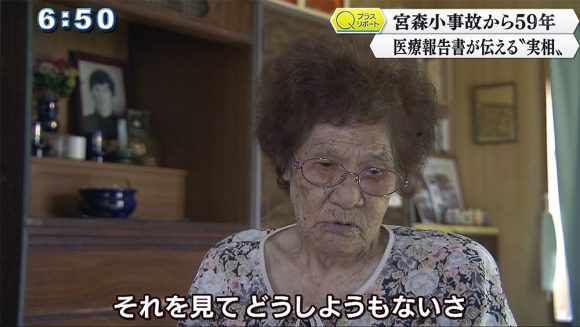 Qプラスリポート 宮森事故59年 医療報告書が示す事故の実相