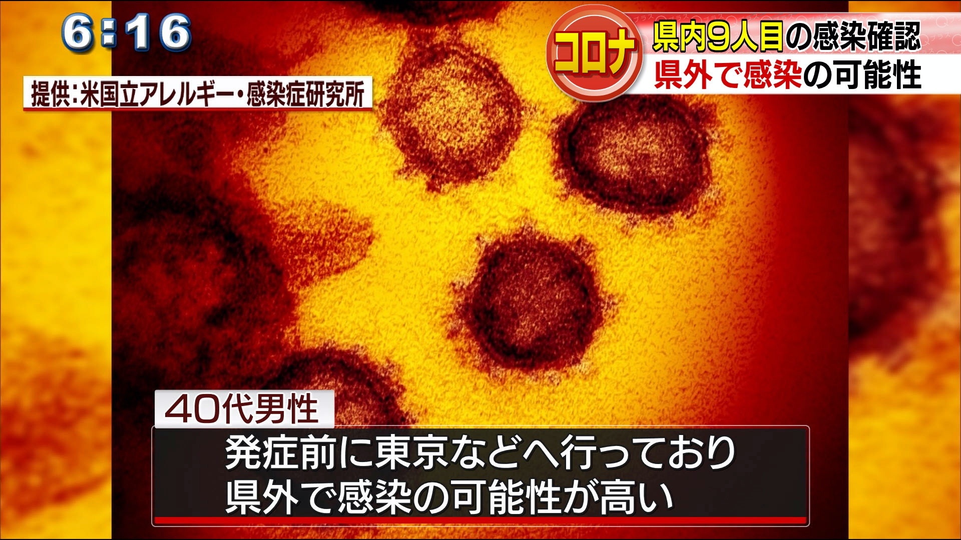 新型コロナ　県内９人目の感染確認