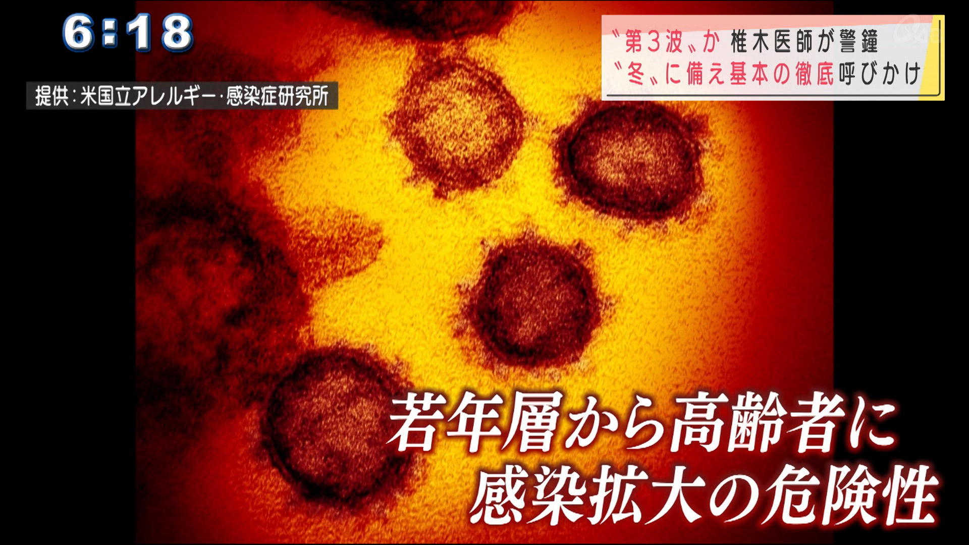 「第３波の入り口に」県内の状況を専門医に聞く