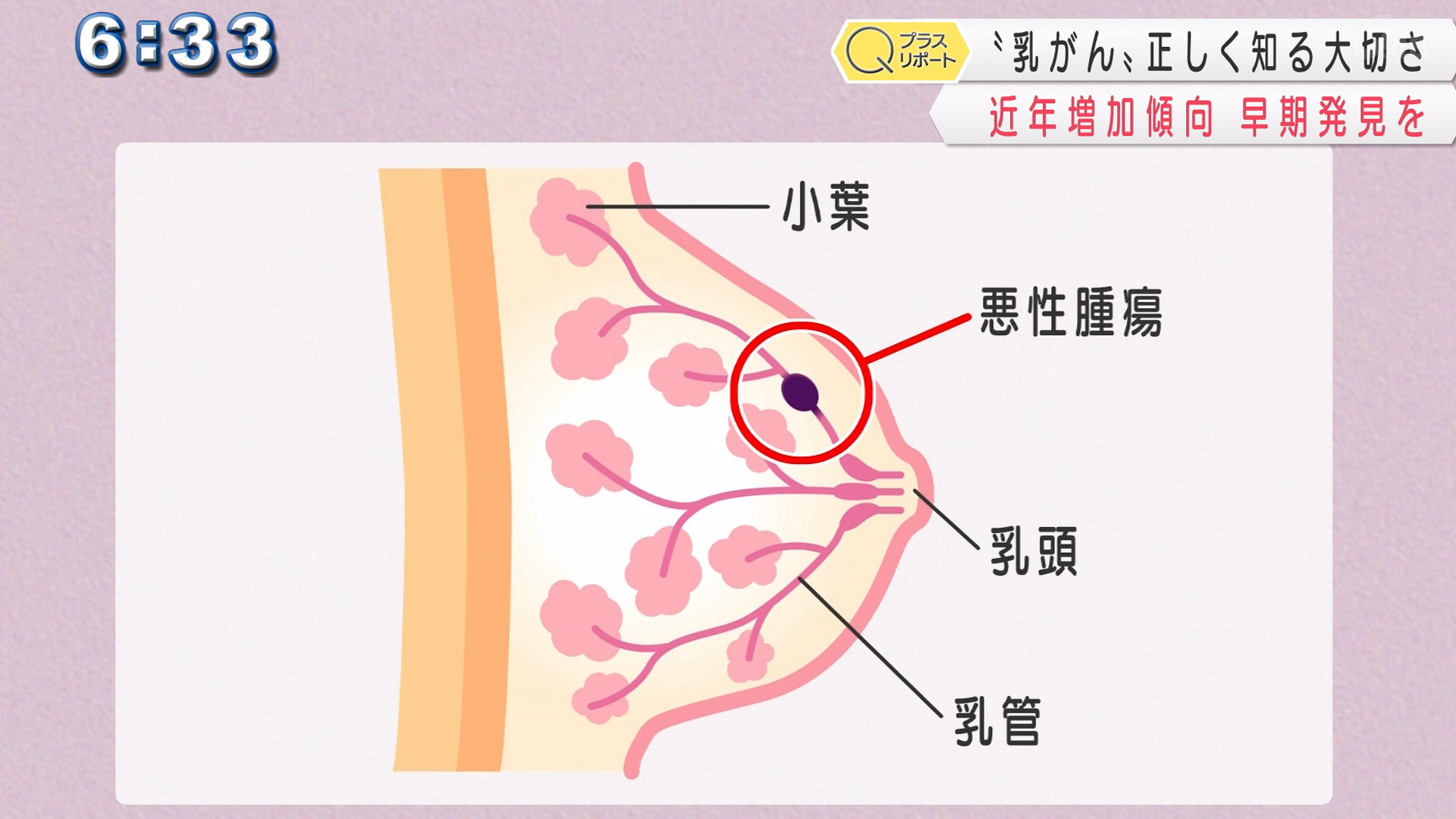 命の母ホワイト 副作用 口コミ