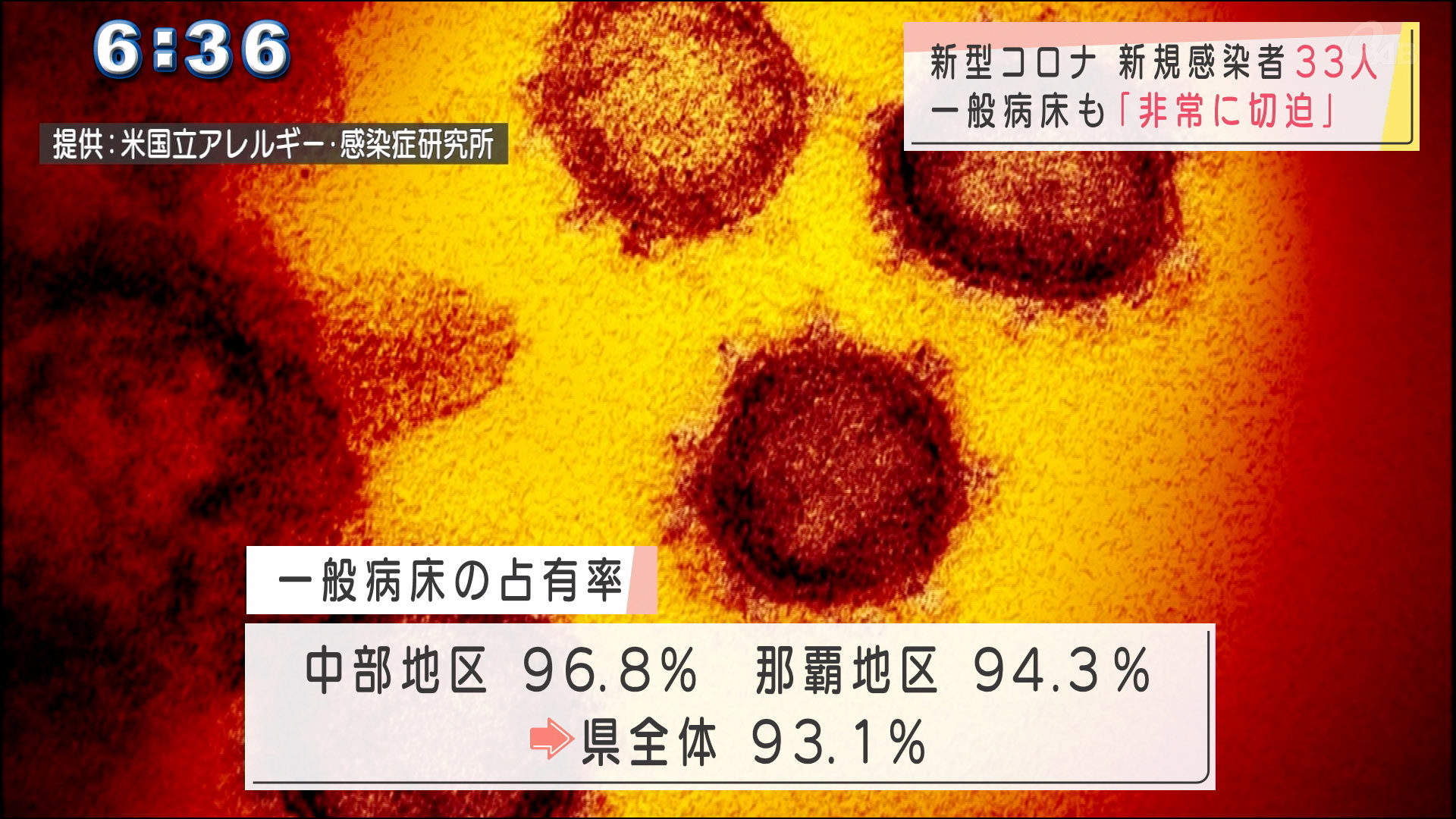 沖縄のコロナ新規感染者３３人　一般病床もひっ迫