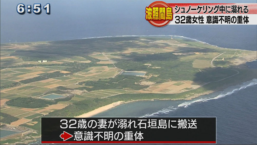 シュノーケリング女性が溺れ意識不明の重体 Qab News Headline