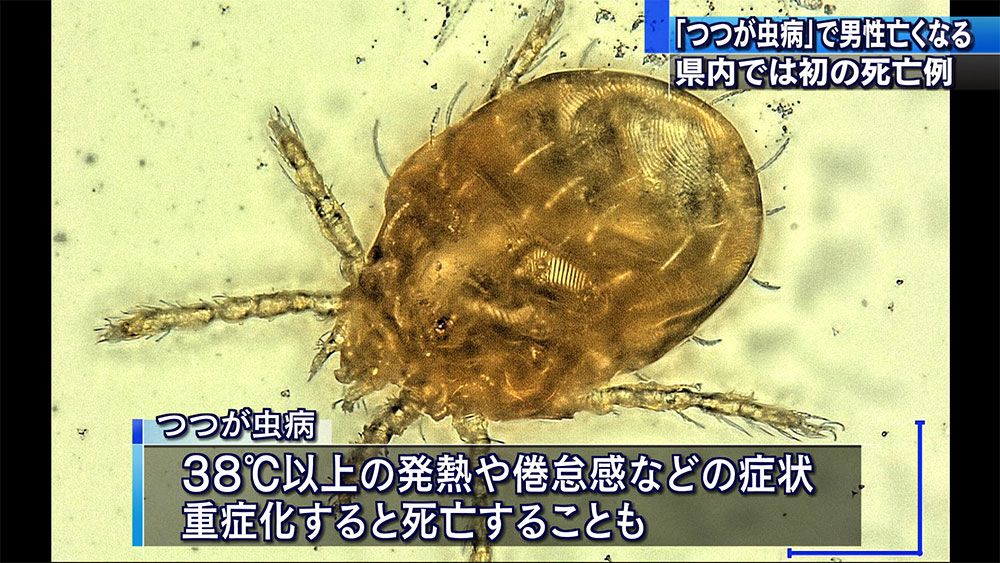 「つつが虫病」で県内初の死亡例