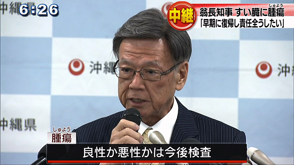 知事 すい臓に腫瘍 手術へ