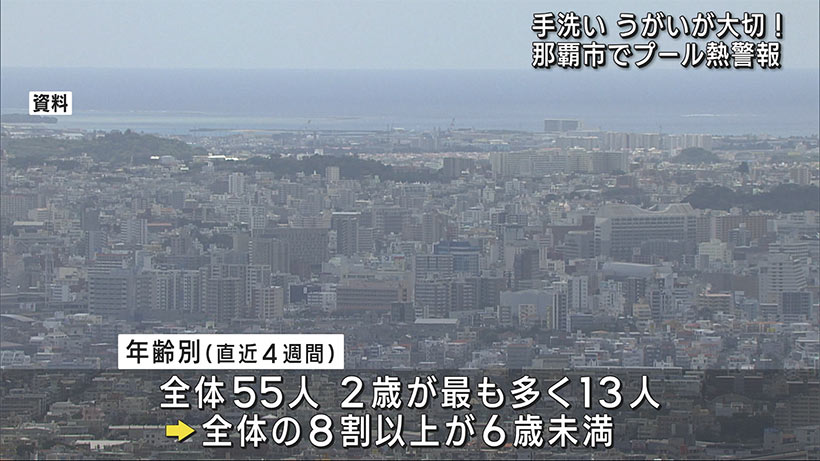 那覇市でプール熱増加　中核市移行初の警報を発令