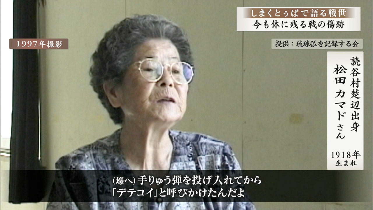 しまくとぅばで語る戦世2025 #67 「今も体に残る戦の傷跡」