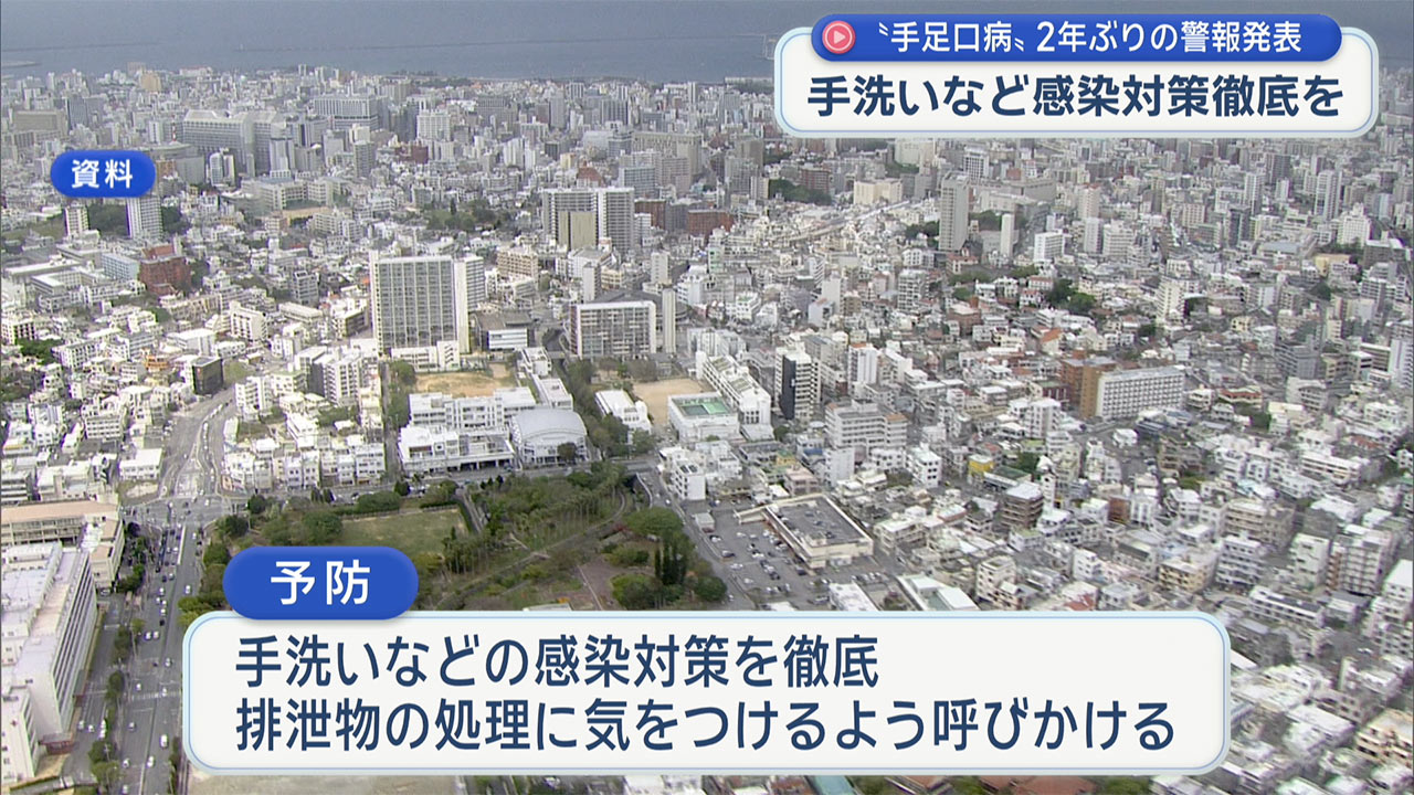 手足口病 県内でも流行　県が２年ぶりに警報発表