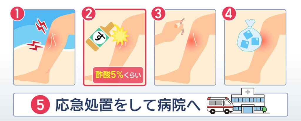 海に潜む危険生物 その対策とは？　ハブクラゲとオコゼを解説