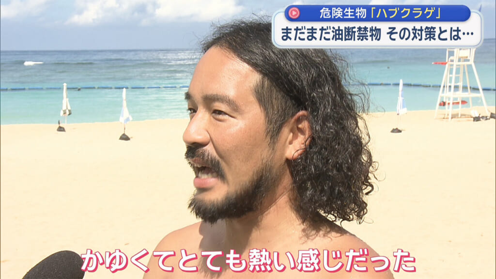 海に潜む危険生物 その対策とは？　ハブクラゲとオコゼを解説