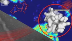 難病ALSの原因物質を抑制する因子発見　治療法の開発につながると期待