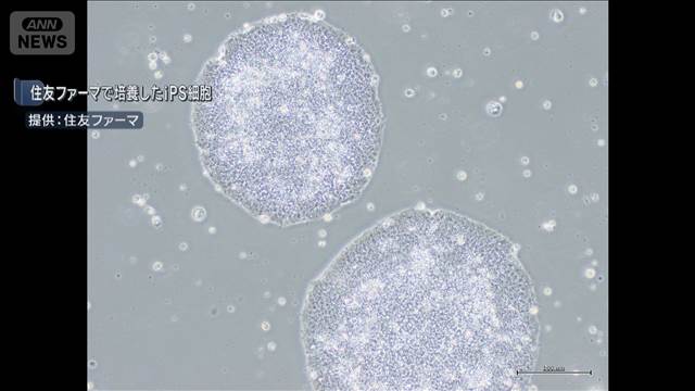 iPS細胞の2製品を承認　世界初となる実用化へ