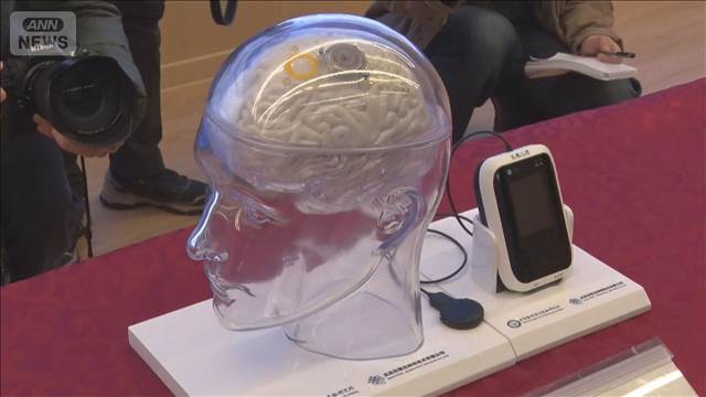 “脳に機械”接続　最先端の医療機器公開　中国