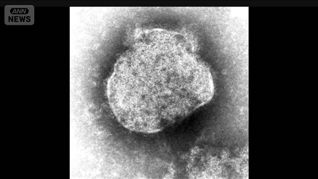 はしか感染者数急増　去年の同時期の4倍超に