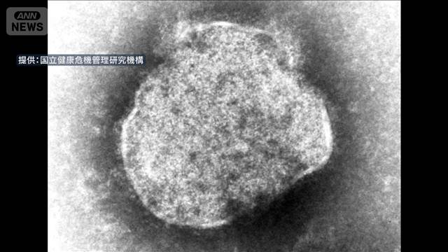 小学校ではしか集団感染　47人に急増　東京・新宿区