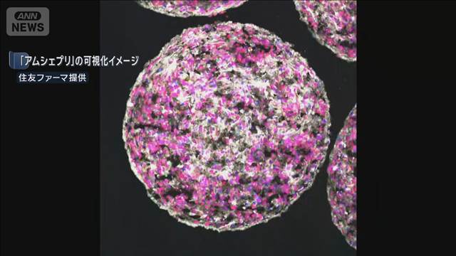 iPS細胞由来の再生医療製品　パーキンソン病患者に初移植